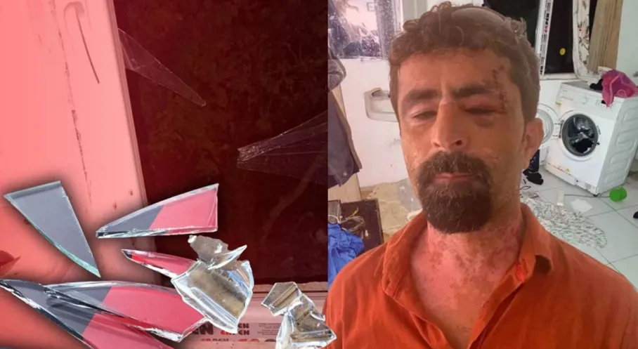 Antalya'da Şok! Damat Kayınpederini Cam Kırıklarıyla Yaraladı!