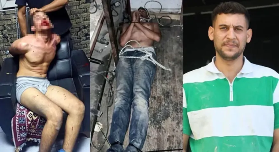 Antalya'da Şok İşkence! Böcek Yedirip Dişlerini Kırdılar: Savcıdan 20'şer Yıl Hapis İstemi