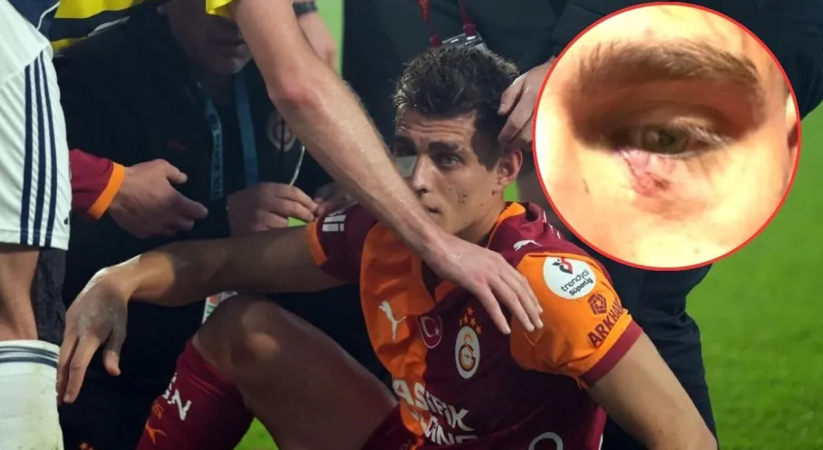 Derbi Çılgınlığı: Sahaya Çakmak Atan Taraftar Gözaltında! Şiddet ve Düzensizlik Soruşturması